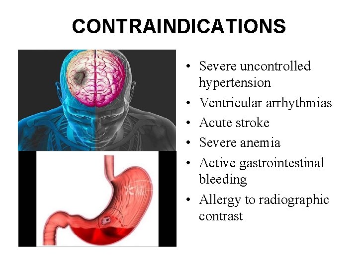 CONTRAINDICATIONS • Severe uncontrolled hypertension • Ventricular arrhythmias • Acute stroke • Severe anemia CONTRAINDICATIONS • Severe uncontrolled hypertension • Ventricular arrhythmias • Acute stroke • Severe anemia