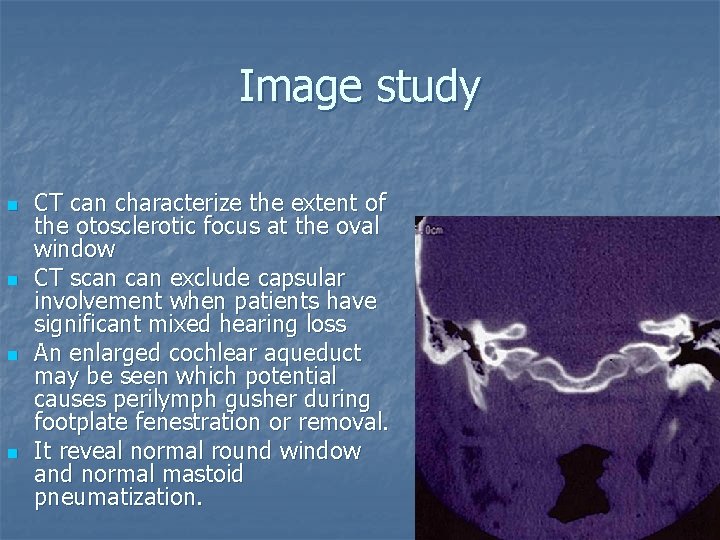 Image study n n CT can characterize the extent of the otosclerotic focus at