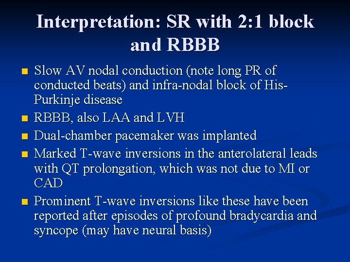 Interpretation: SR with 2: 1 block and RBBB n n n Slow AV nodal