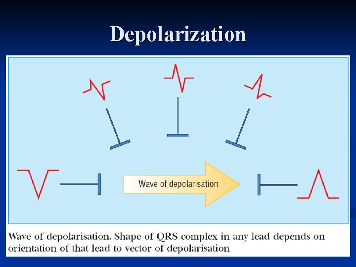 Depolarization 