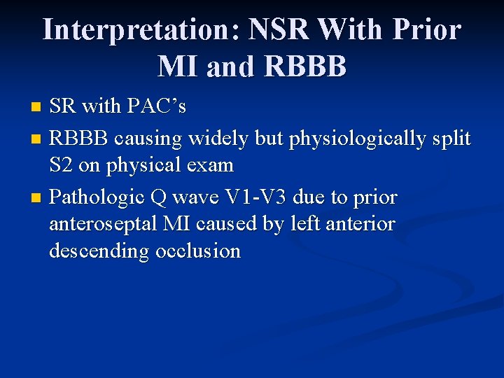 Interpretation: NSR With Prior MI and RBBB SR with PAC’s n RBBB causing widely