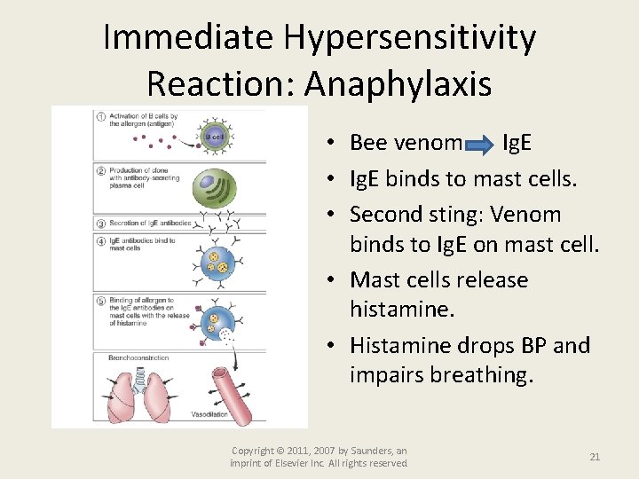 Immediate Hypersensitivity Reaction: Anaphylaxis • Bee venom Ig. E • Ig. E binds to