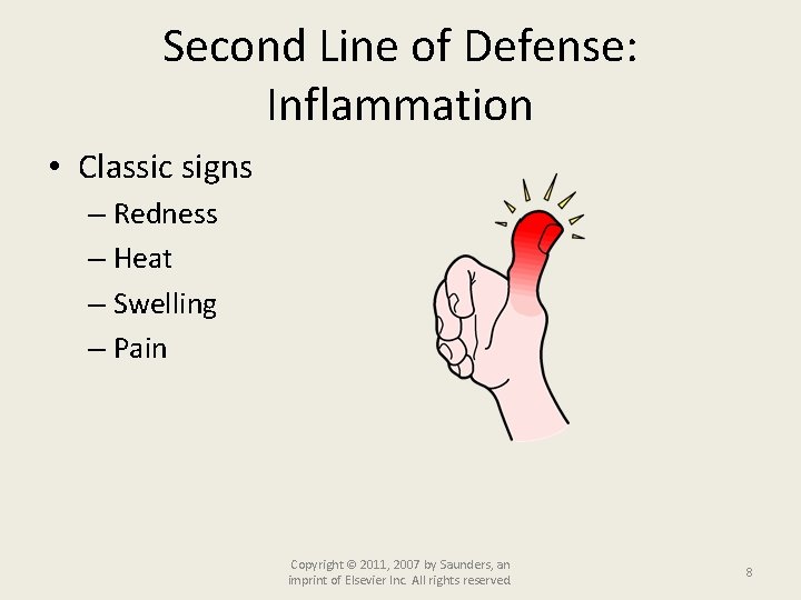Second Line of Defense: Inflammation • Classic signs – Redness – Heat – Swelling