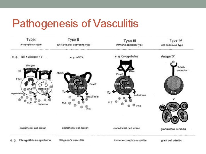 Pathogenesis of Vasculitis 