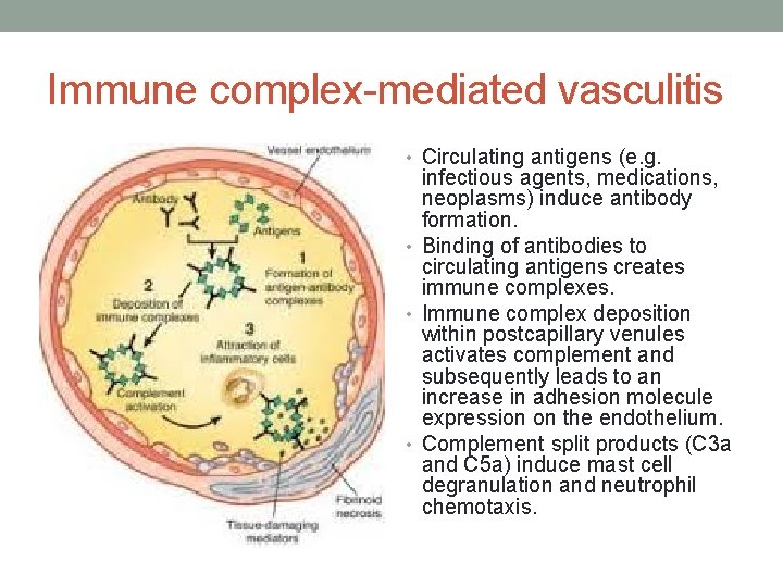 Immune complex-mediated vasculitis • Circulating antigens (e. g. infectious agents, medications, neoplasms) induce antibody