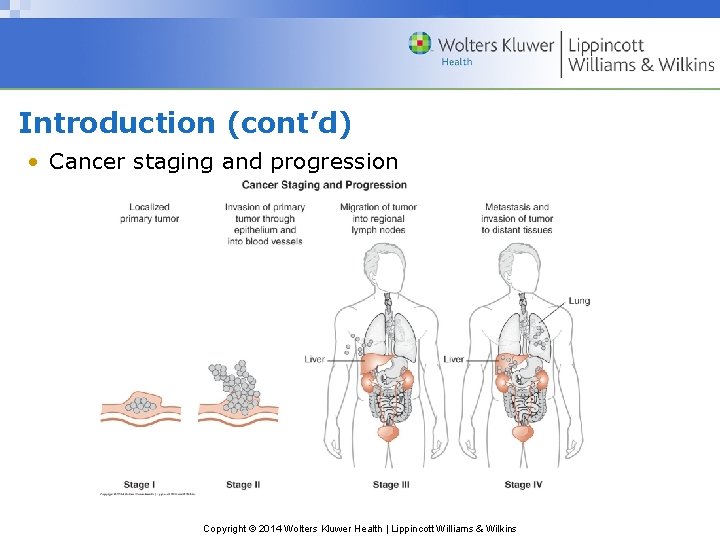 Introduction (cont’d) • Cancer staging and progression Copyright © 2014 Wolters Kluwer Health |