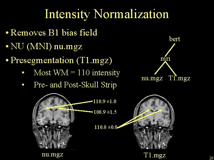 Intensity Normalization • Removes B 1 bias field • NU (MNI) nu. mgz •