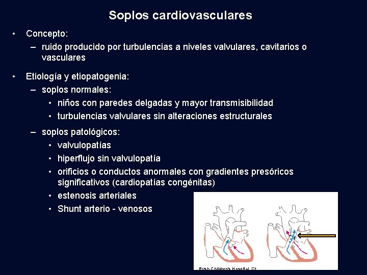 Soplos cardiovasculares • Concepto: – ruido producido por turbulencias a niveles valvulares, cavitarios o