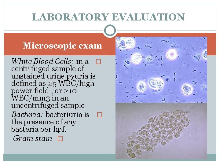 LABORATORY EVALUATION Microscopic exam White Blood Cells: in a � centrifuged sample of unstained