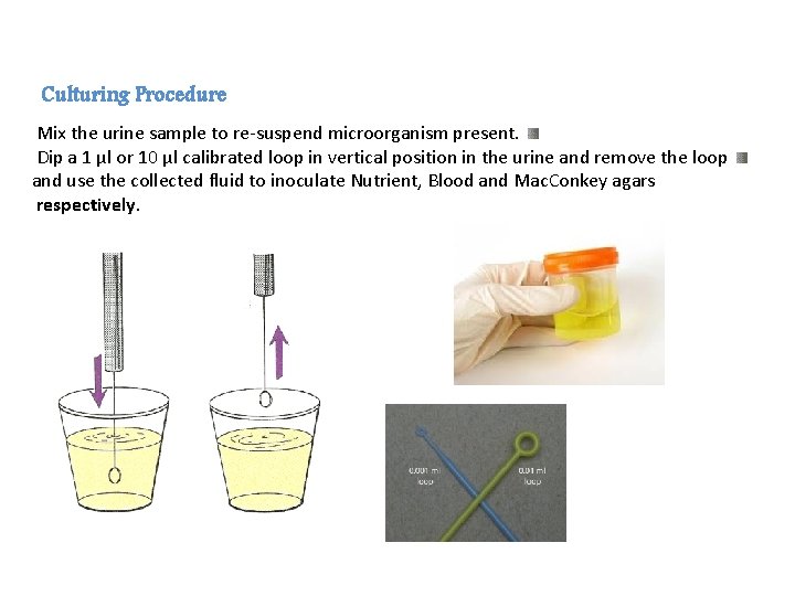 Culturing Procedure Mix the urine sample to re-suspend microorganism present. Dip a 1 μl