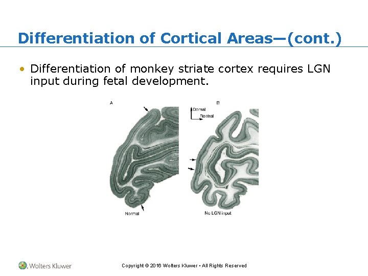 Differentiation of Cortical Areas—(cont. ) • Differentiation of monkey striate cortex requires LGN input