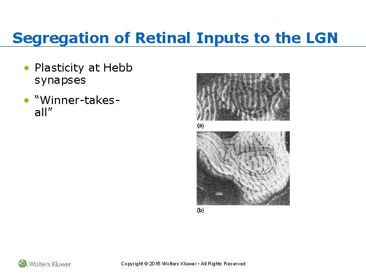 Segregation of Retinal Inputs to the LGN • Plasticity at Hebb synapses • “Winner-takesall”