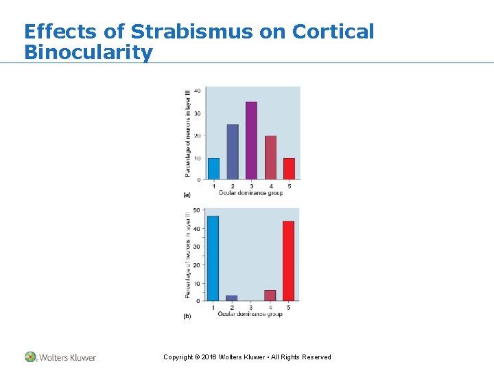 Effects of Strabismus on Cortical Binocularity Copyright © 2016 Wolters Kluwer • All Rights