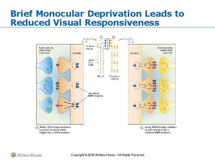 Brief Monocular Deprivation Leads to Reduced Visual Responsiveness Copyright © 2016 Wolters Kluwer •