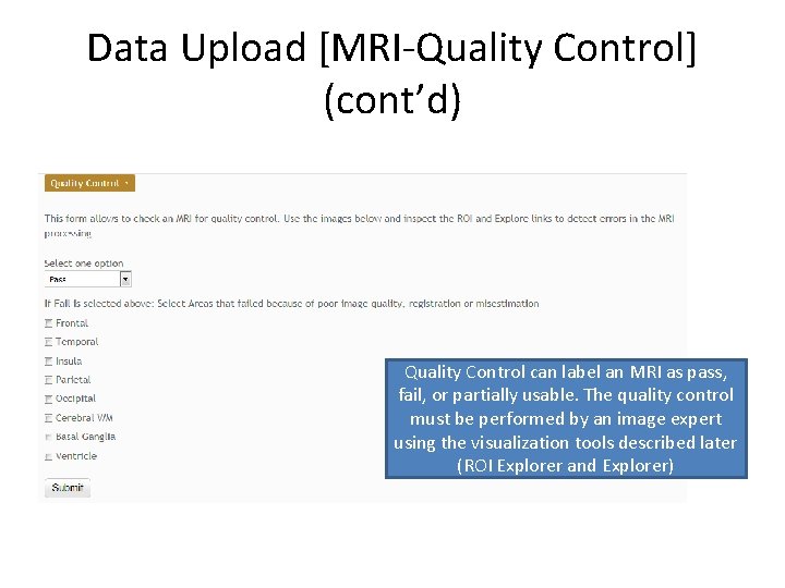 Data Upload [MRI-Quality Control] (cont’d) Quality Control can label an MRI as pass, fail,