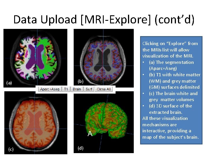 Data Upload [MRI-Explore] (cont’d) (a) (c) (b) (d) Clicking on “Explore” from the MRIs