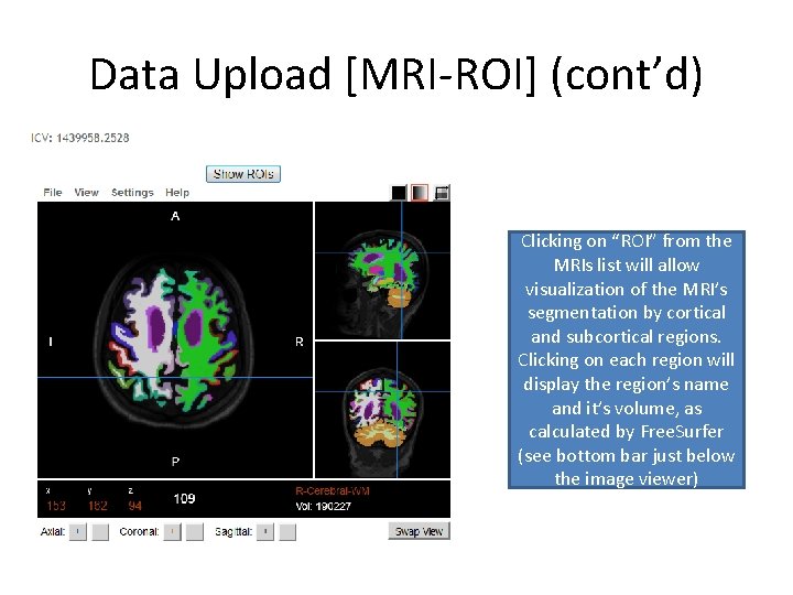 Data Upload [MRI-ROI] (cont’d) Clicking on “ROI” from the MRIs list will allow visualization