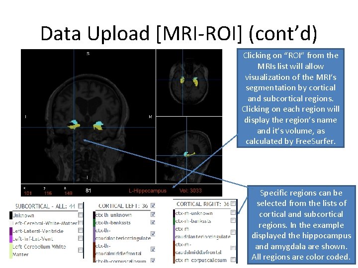 Data Upload [MRI-ROI] (cont’d) Clicking on “ROI” from the MRIs list will allow visualization