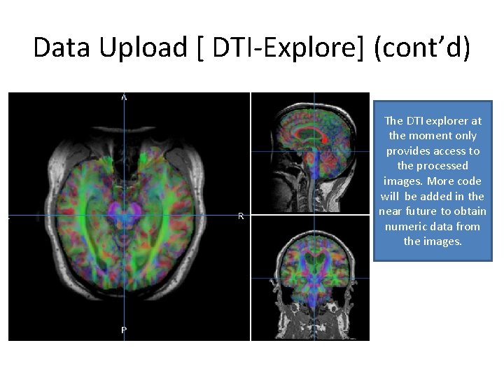 Data Upload [ DTI-Explore] (cont’d) The DTI explorer at the moment only provides access