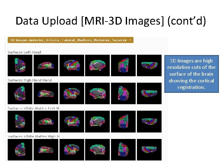 Data Upload [MRI-3 D Images] (cont’d) 3 D Images are high resolution cuts of
