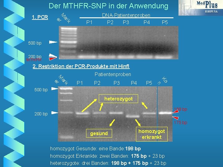 Der MTHFR-SNP in der Anwendung k ar M er 1. PCR DNA-Patientenproben P 2