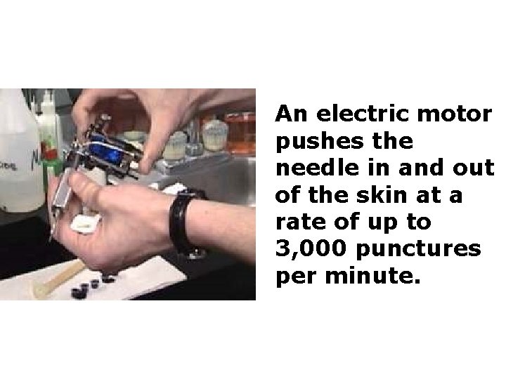An electric motor pushes the needle in and out of the skin at a