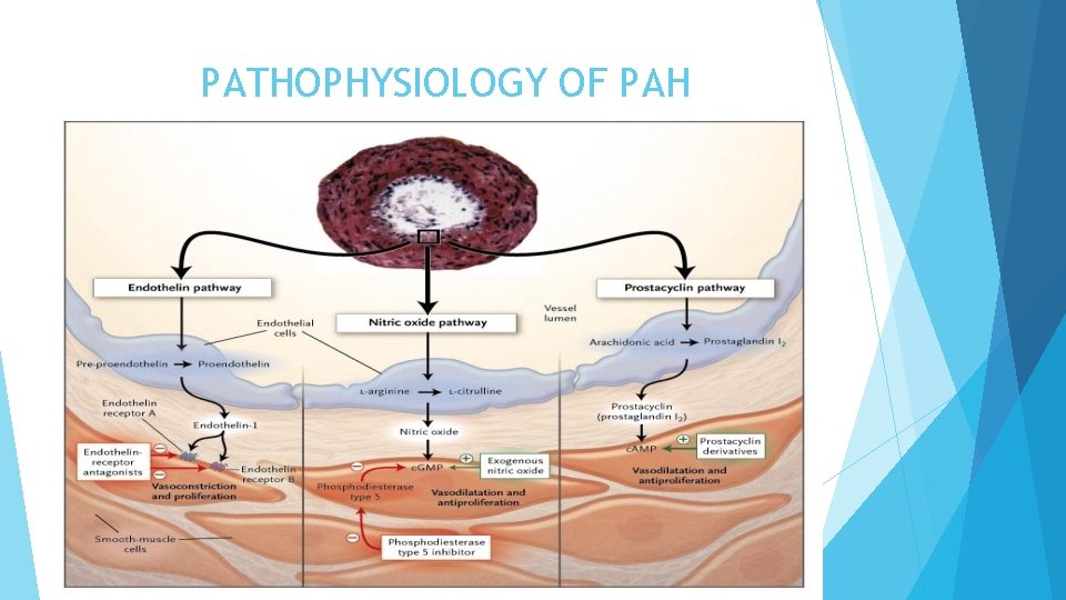 PATHOPHYSIOLOGY OF PAH 