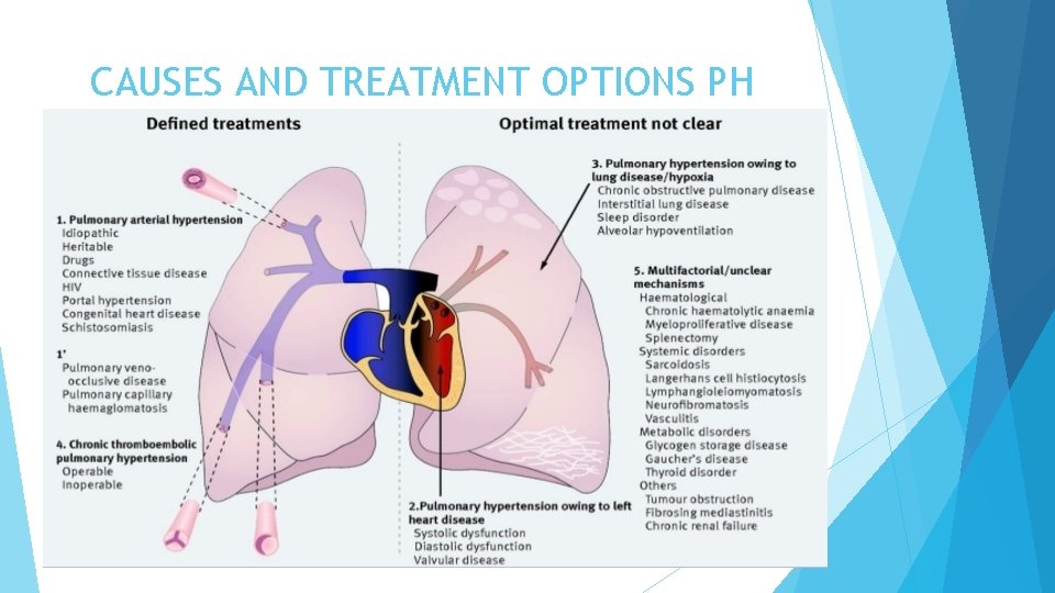 CAUSES AND TREATMENT OPTIONS PH 