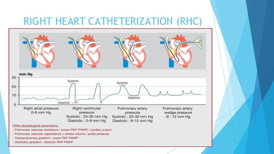 RIGHT HEART CATHETERIZATION (RHC) 