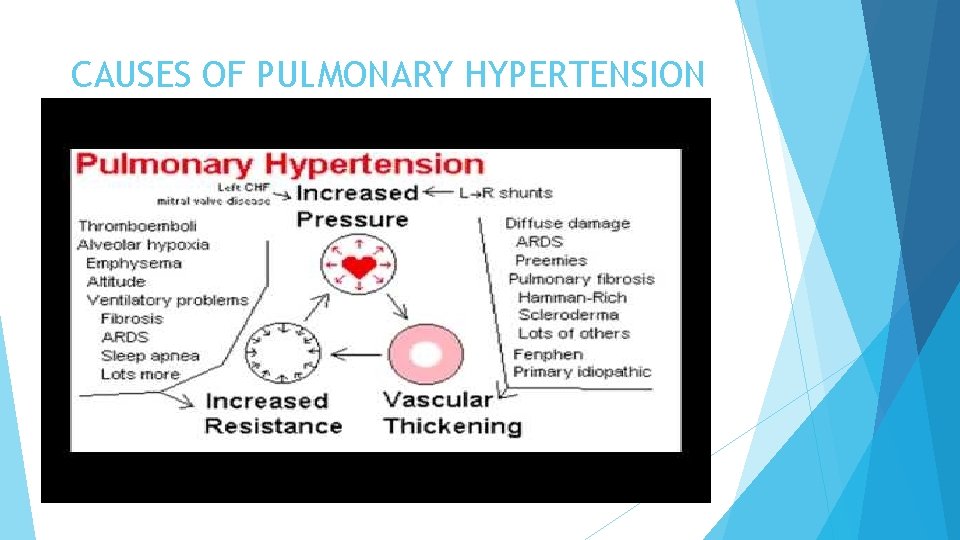 CAUSES OF PULMONARY HYPERTENSION 