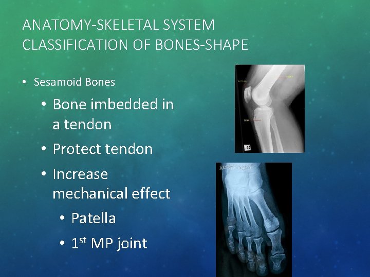 ANATOMY-SKELETAL SYSTEM CLASSIFICATION OF BONES-SHAPE • Sesamoid Bones • Bone imbedded in a tendon