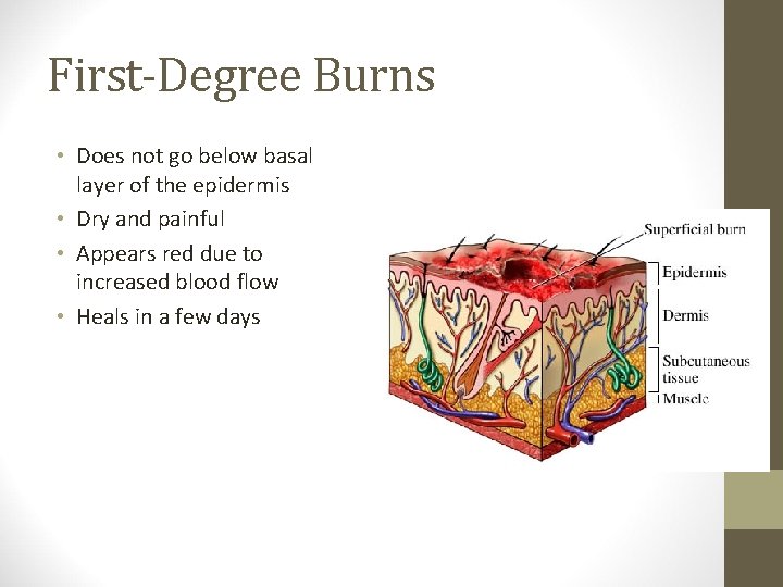 First-Degree Burns • Does not go below basal layer of the epidermis • Dry