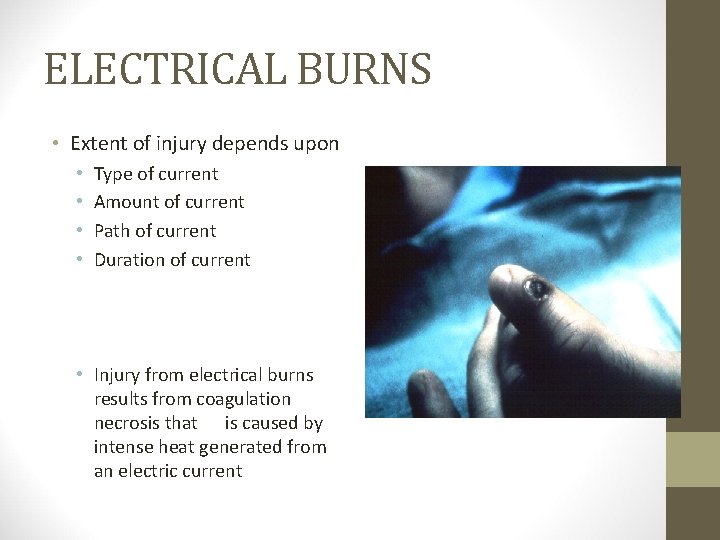 ELECTRICAL BURNS • Extent of injury depends upon • • Type of current Amount