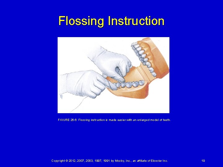 Flossing Instruction FIGURE 26 -6 Flossing instruction is made easier with an enlarged model of