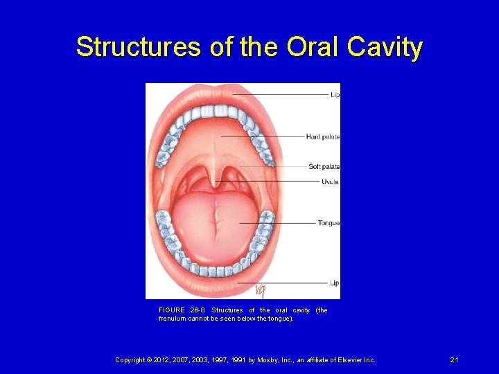 Structures of the Oral Cavity FIGURE 26 -8  Structures of the oral cavity (the