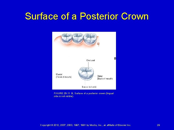 Surface of a Posterior Crown FIGURE 26 -11 B, Surface of a posterior crown (lingual