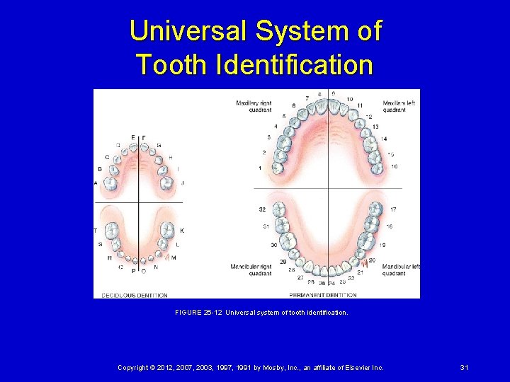 Universal System of Tooth Identification FIGURE 26 -12 Universal system of tooth identification. Copyright ©