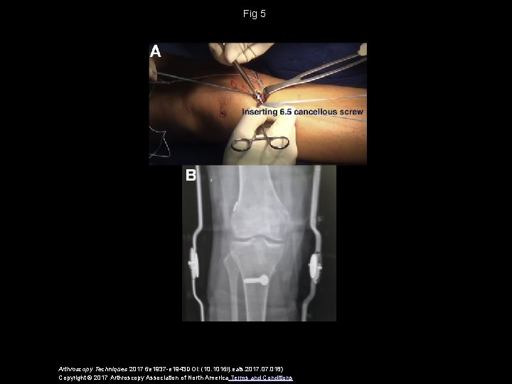 Fig 5 Arthroscopy Techniques 2017 6 e 1937 -e 1943 DOI: (10. 1016/j. eats.