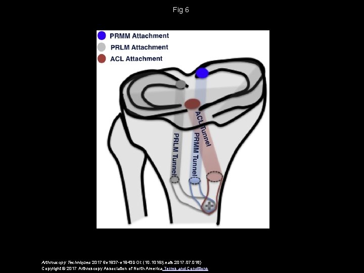 Fig 6 Arthroscopy Techniques 2017 6 e 1937 -e 1943 DOI: (10. 1016/j. eats.