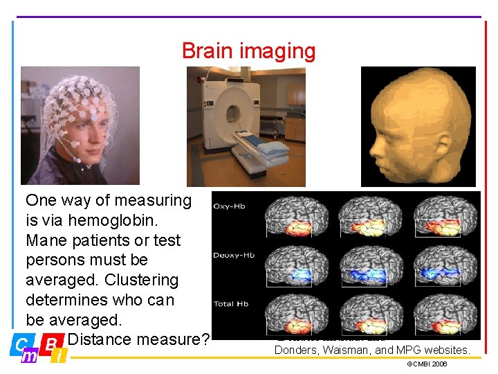 Brain imaging One way of measuring is via hemoglobin. Mane patients or test persons