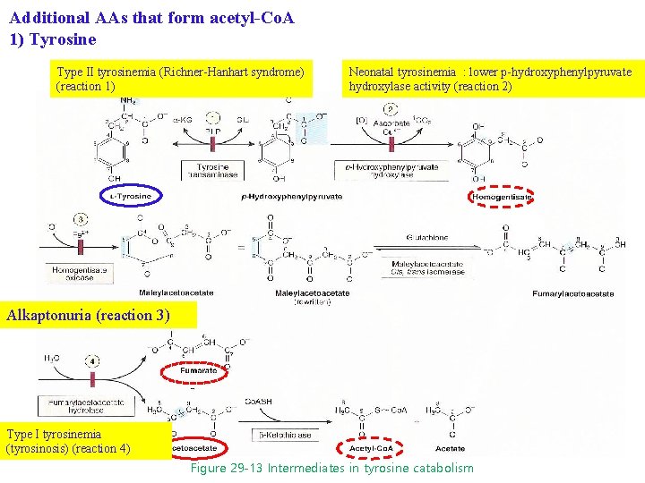 Additional AAs that form acetyl-Co. A 1) Tyrosine Type II tyrosinemia (Richner-Hanhart syndrome) (reaction