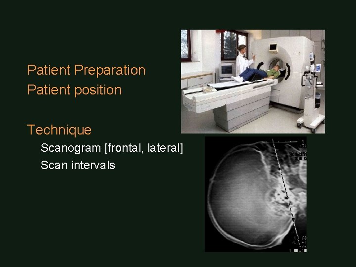 Patient Preparation Patient position Technique Scanogram [frontal, lateral] Scan intervals 