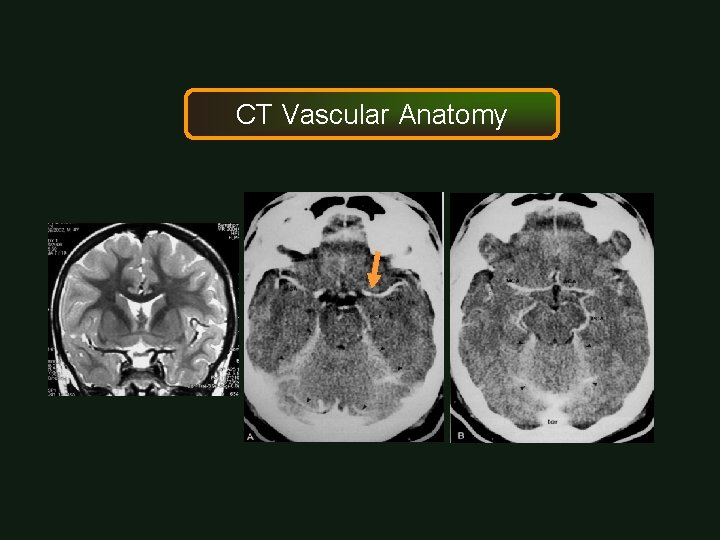CT Vascular Anatomy 