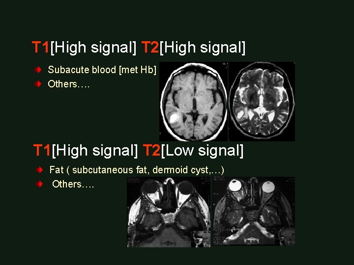 T 1[High signal] T 2[High signal] Subacute blood [met Hb] Others…. T 1[High signal]
