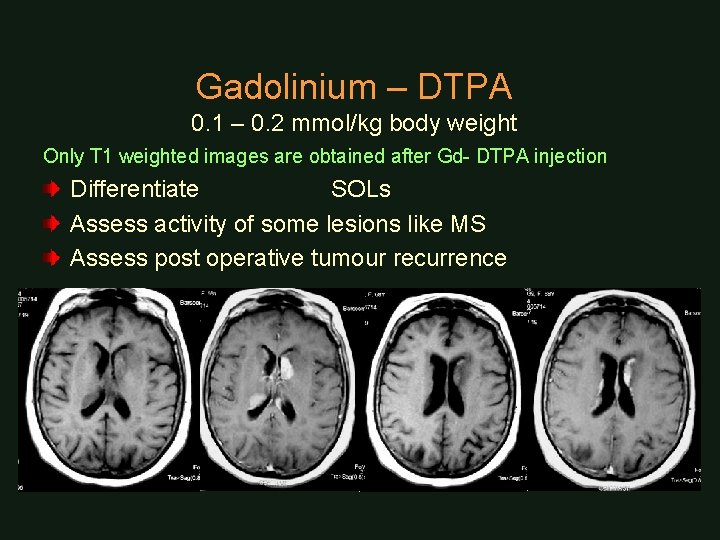 Gadolinium – DTPA 0. 1 – 0. 2 mmol/kg body weight Only T 1