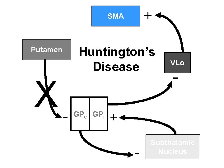 + SMA Putamen X- Huntington’s Disease VLo - ++ GPe GPi - Subthalamic Nucleus