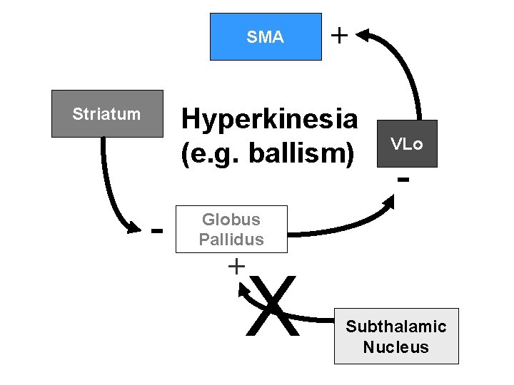 SMA + Hyperkinesia (e. g. ballism) Striatum - VLo - Globus Pallidus + X