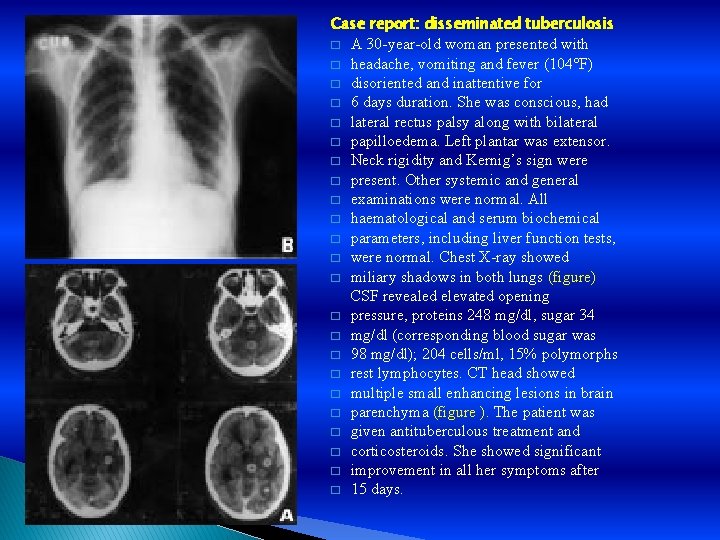 Case report: disseminated tuberculosis � � � � � � A 30 -year-old woman