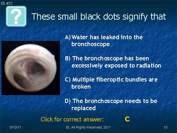 EB #35 These small black dots signify that A) Water has leaked into the