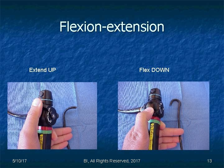Flexion-extension Extend UP 5/10/17 Flex DOWN BI, All Rights Reserved, 2017 13 